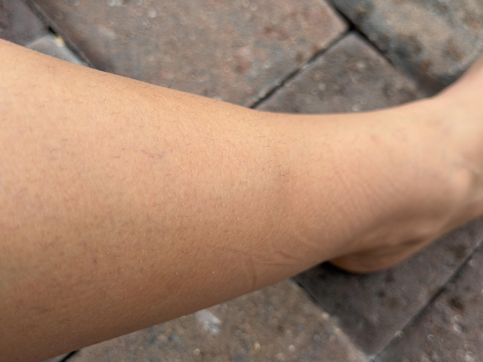 Braun Smart IPL, Skin i-Expert Pro 7, VOGUE's Best Hair Removal Device, IPL Hair Removal for Women and Men, Permanent Laser Hair Reduction At-Home, World's 1st Smart App, 4 Heads, IPL7387 customer photo 2