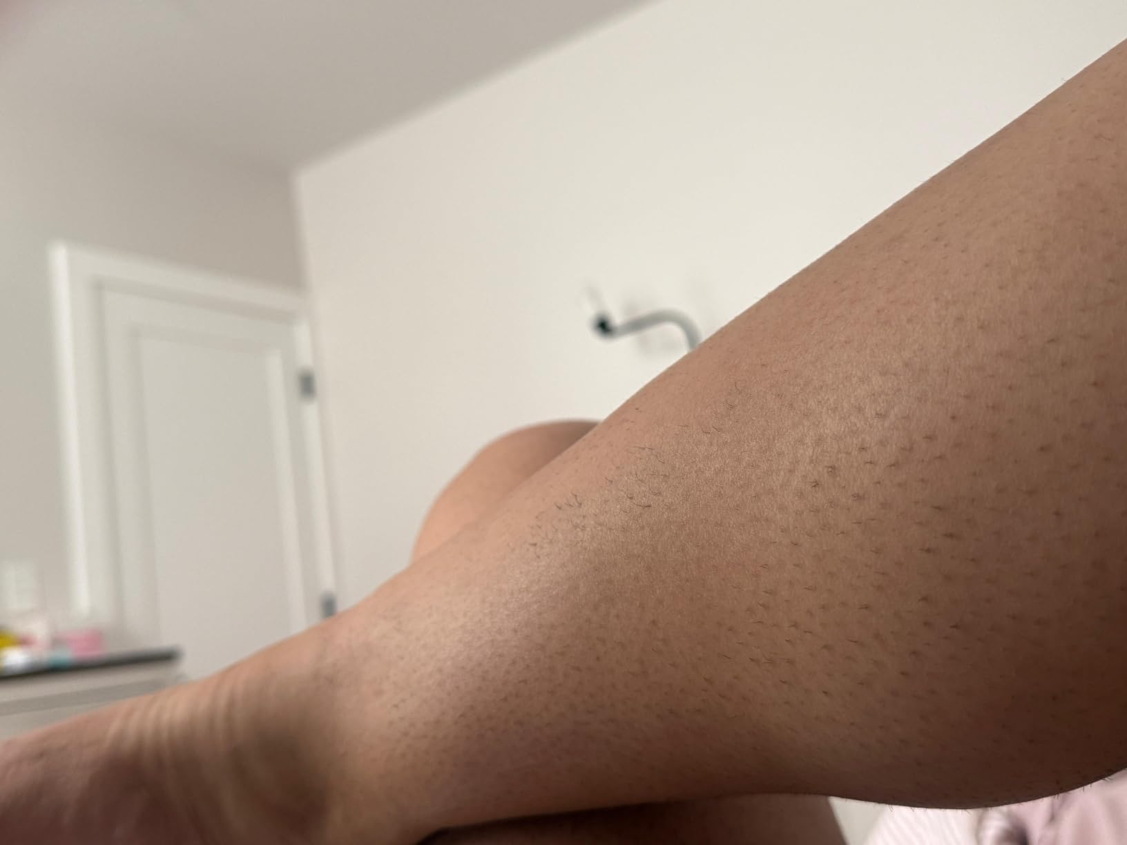 Philips Lumea 8000 Series IPL Hair Removal Device, Permanent Laser Hair Reduction for Women & Men, Easy and Comfortable Use at Home, SenseIQ, 3 Attachments for Body, Face, Intimate, BRI937/03 customer photo 1