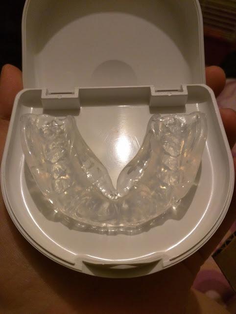The Doctor's NightGuard Mouth Guard for Grinding Teeth at Night, 1 Count | BPA-Free, Dental Guard for Bruxism, Night Guard for Teeth, Includes Storage Case customer photo 1