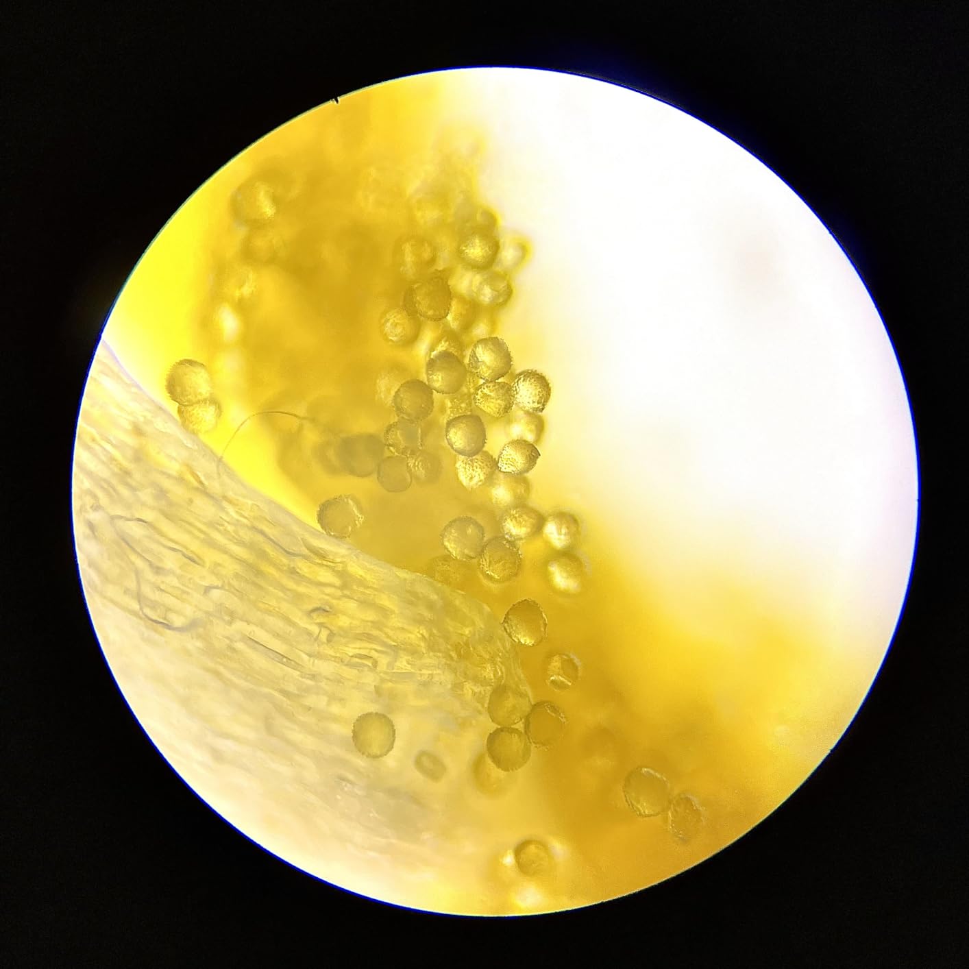 AmScope OMAX M82ES-SC100-LP100 Compound Microscope, 40X-2000X Magnification, with Slides Kit customer photo 1