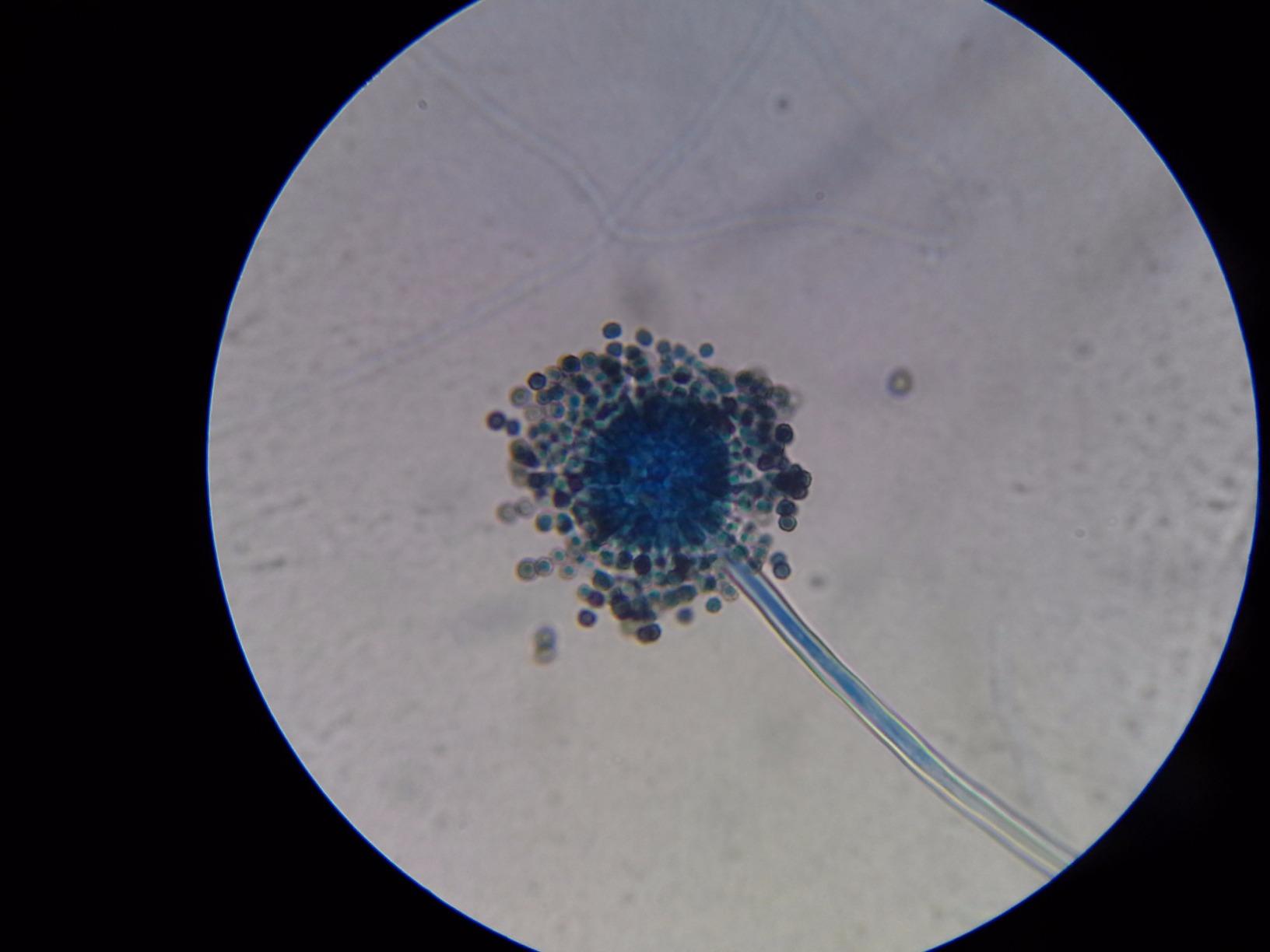AmScope OMAX M82ES-SC100-LP100 Compound Microscope, 40X-2000X Magnification, with Slides Kit customer photo 2