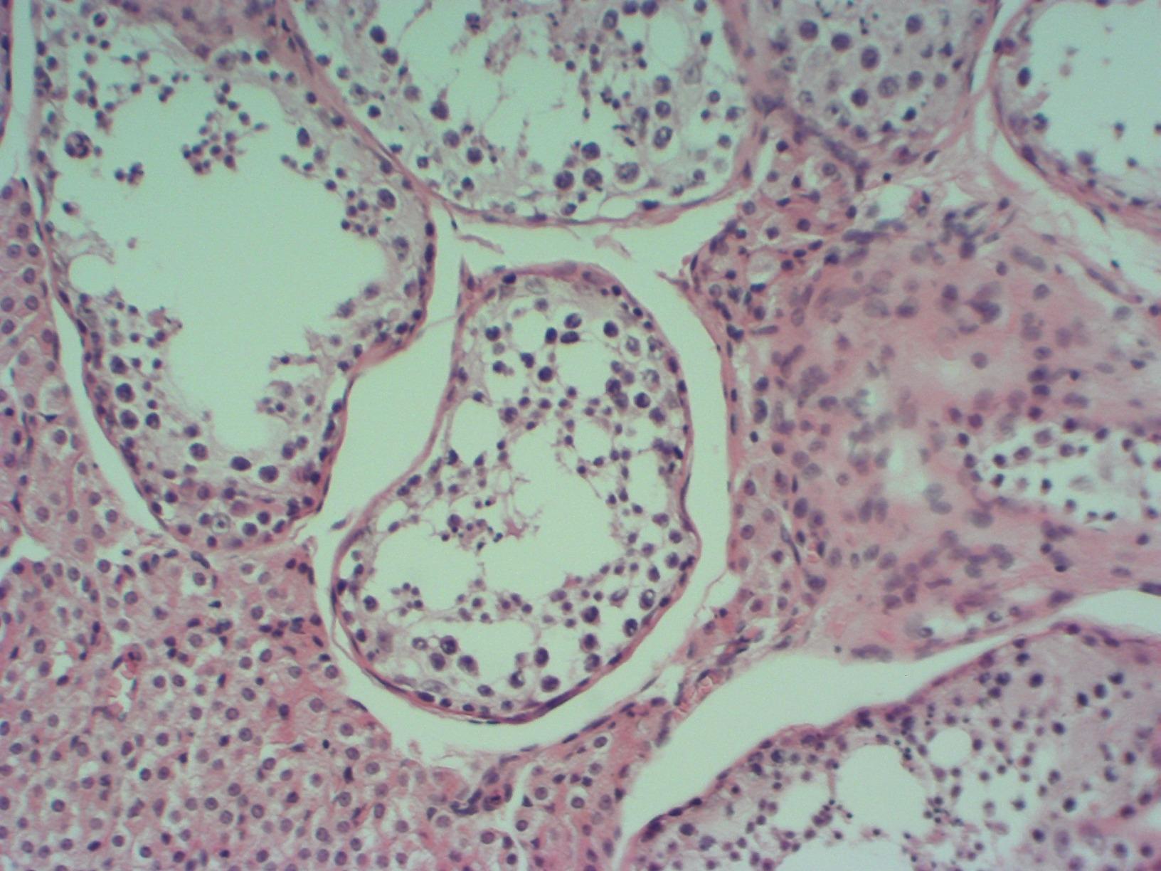 AmScope MD500-CK 5.0 MP USB Still & Live Video Microscope Imager Digital customer photo 1