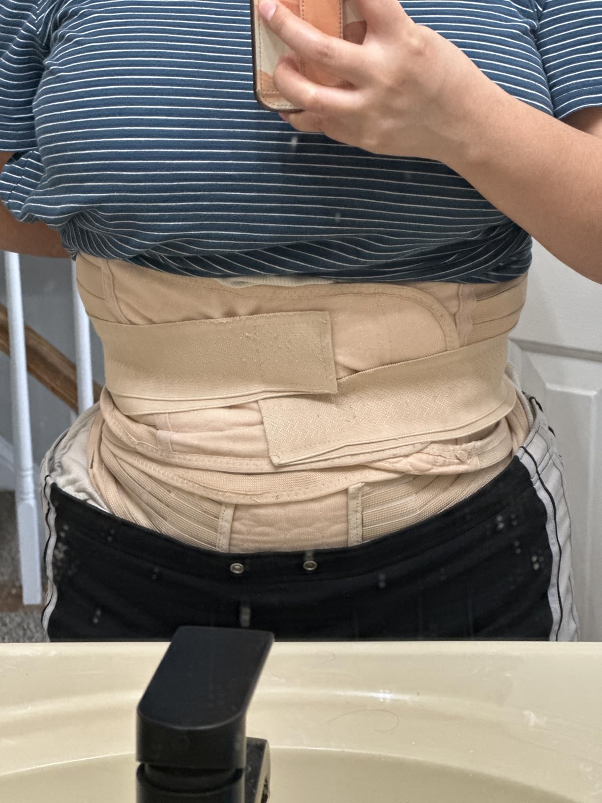 ChongErfei 3 in 1 Postpartum Support - Recovery Belly/waist/pelvis Belt Shapewear Slimming Girdle, Beige, L For Posture Correction customer photo 1