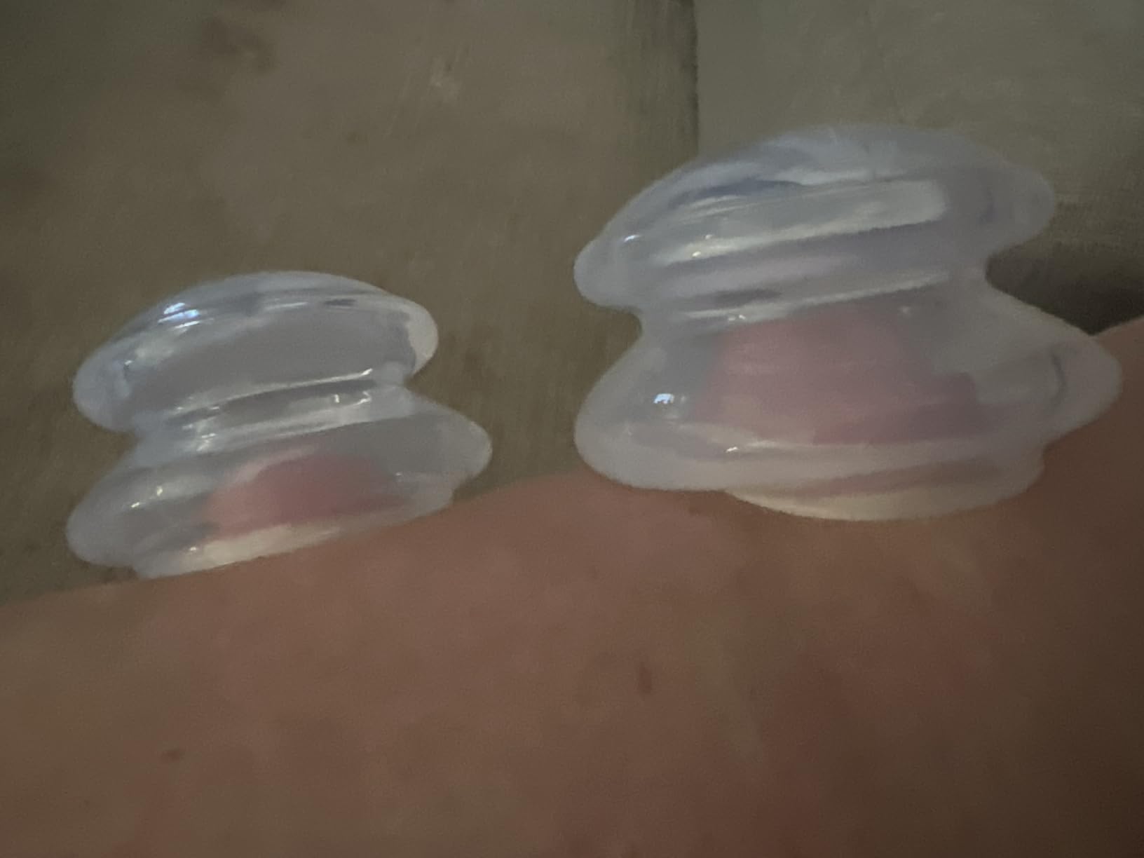 ELERA Silicone Cupping Therapy Set, Professionally Chinese Massage Cups for Cupping Therapy and Cellulite Reduction (7 Cups) customer photo 1