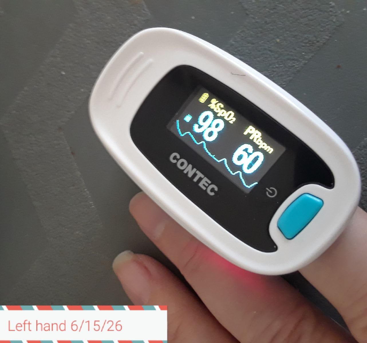 CONTEC Pulse Oximeter, SpO2 & PR Waveform Blood Oxygen Monitor w/Lanyard customer photo 2