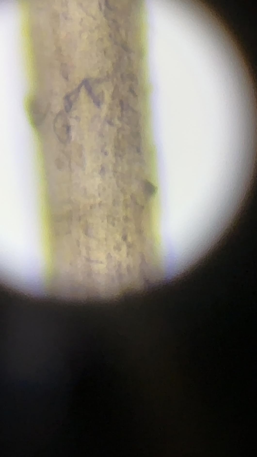 Swift SW380T 40X-2500X Magnification, Siedentopf Head, Research-Grade Trinocular Microscope Compound Lab with Wide-Field 10X/25X Eyepieces, Mechanical Stage, Ultra-Precise Focusing, Camera-Compatible customer photo 2
