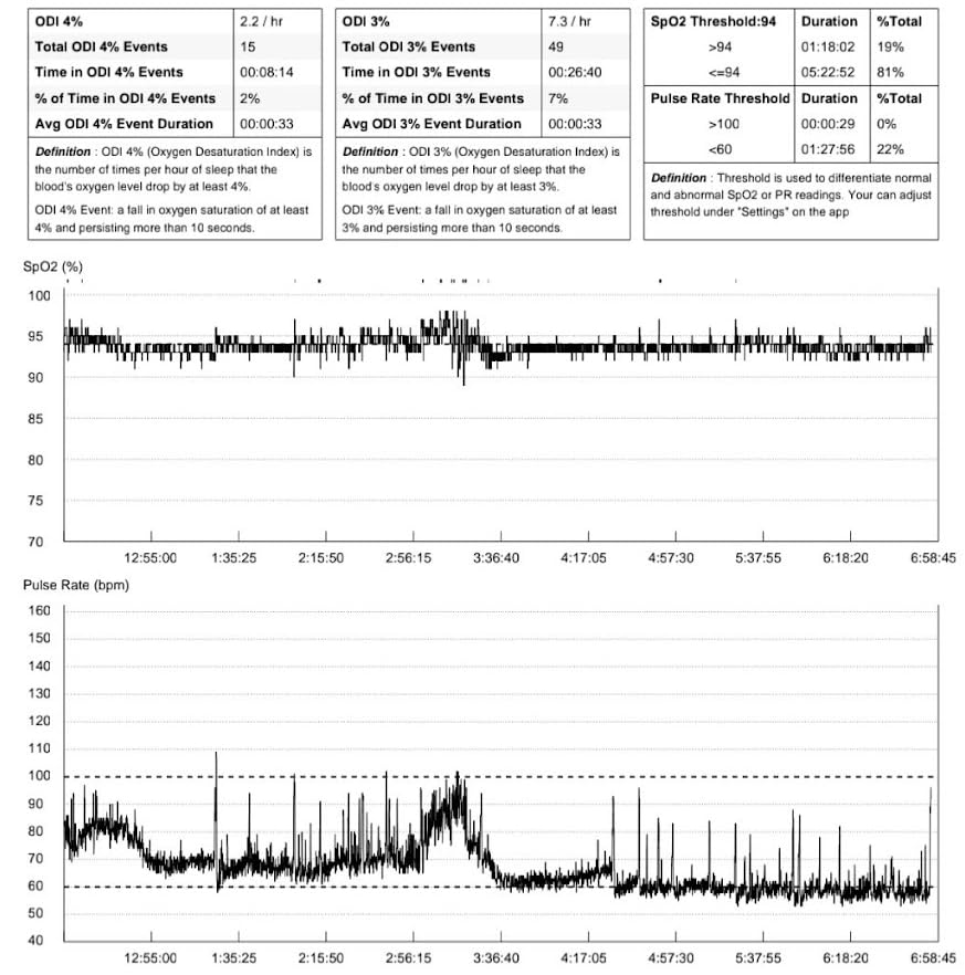 EMAY Sleep Oxygen Monitor with Built-in Recording Capability | Track Continuous Blood Oxygen Levels & Pulse Rate Overnight | Provides Sleep Report & Raw Data customer photo 1