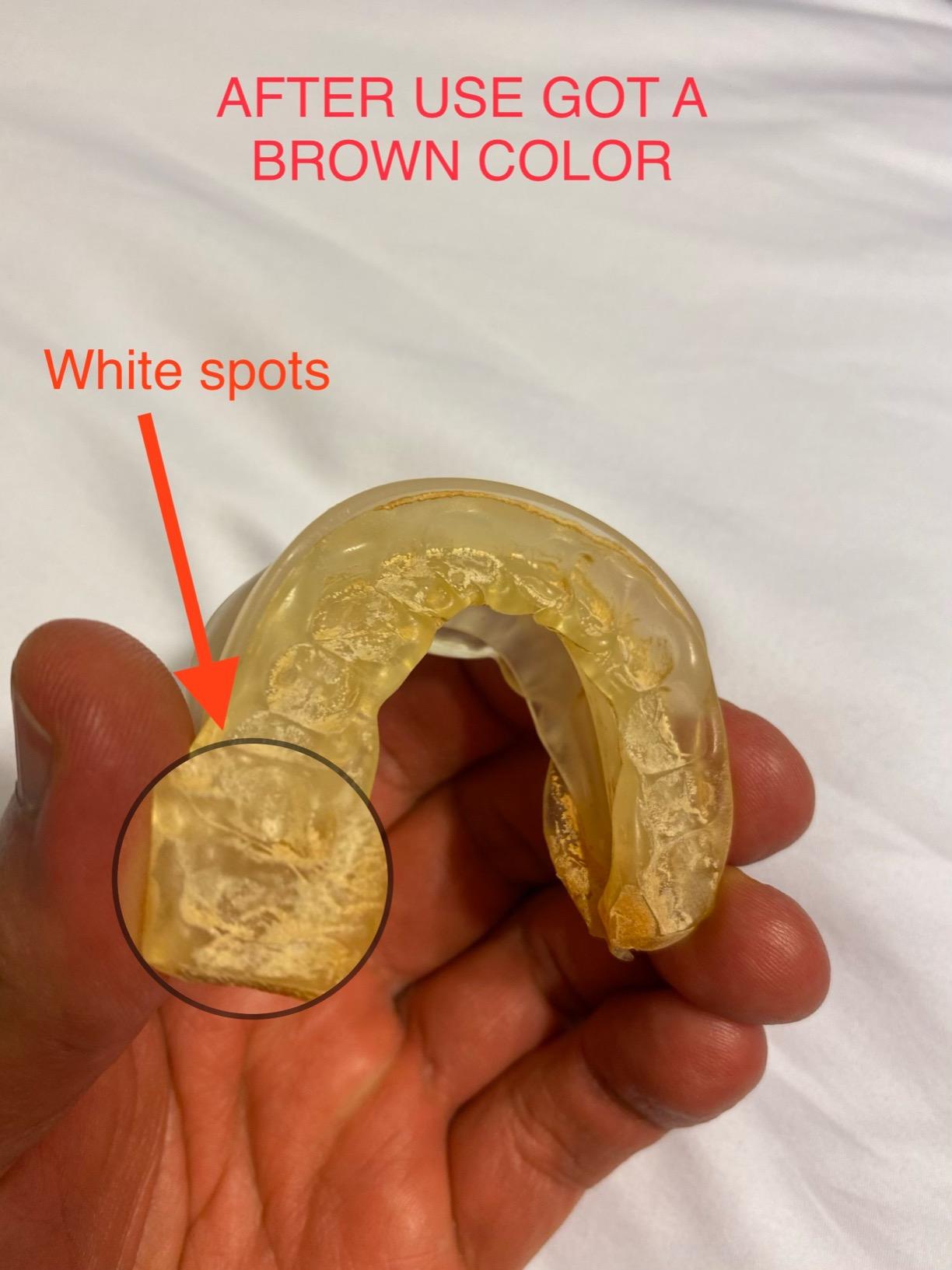 PureSleep - The Original Anti-Snoring Mouthpiece and #1 Solution Worldwide customer photo 1