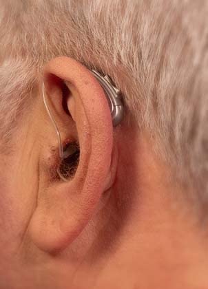 EarCentric EasyCharge Rechargeable Hearing Aids for Seniors and Adults, Behind-the-Ear BTE OTC Hearing Aids with Noise Reduction customer photo 1