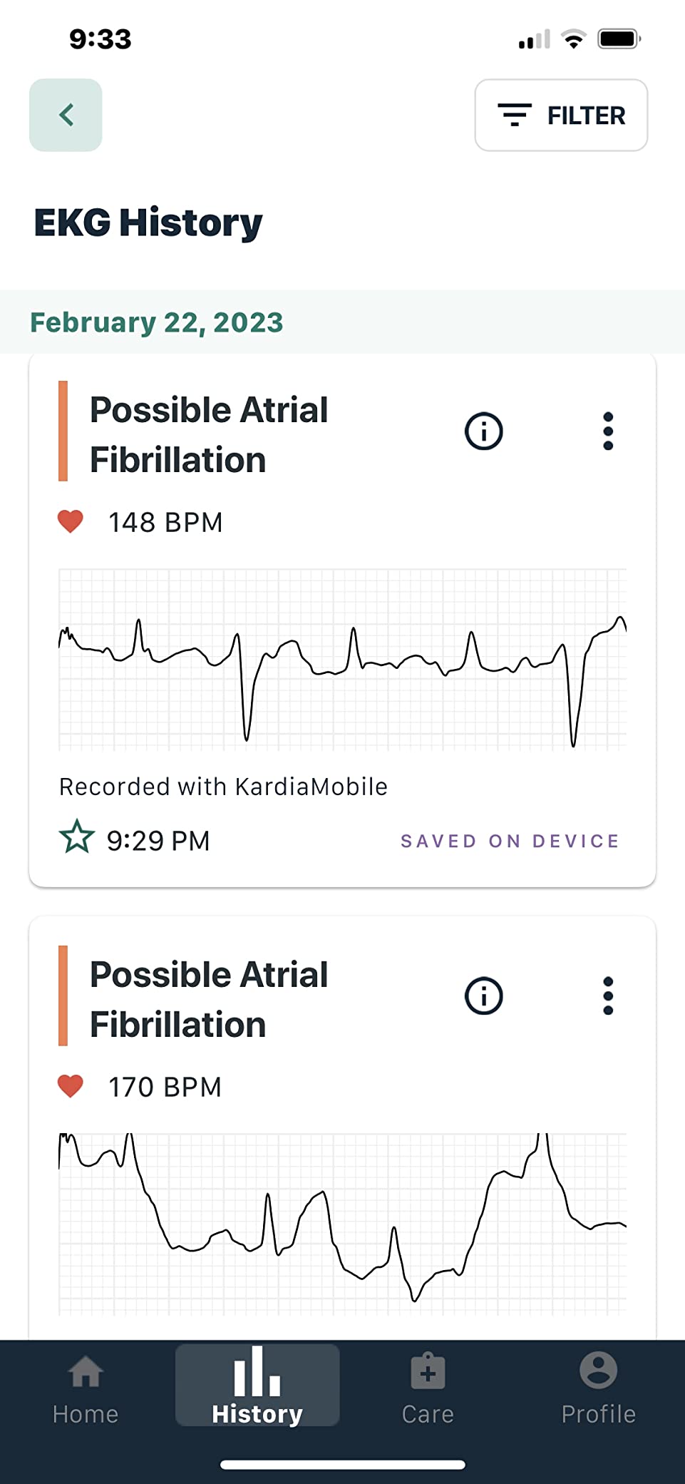 KardiaMobile Card Credit-Card Sized EKG, Medical-Grade & FDA-Cleared Personal Heart Monitor, Bluetooth Enabled, On-The-Go Check-Up Anywhere, Compatible with Most Smartphones, No Subscription Required customer photo 1