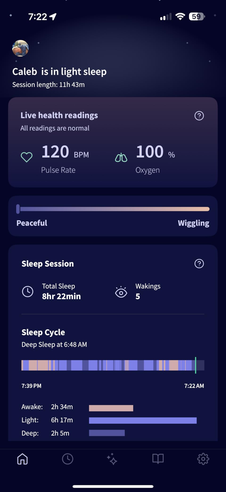 Owlet Dream Sock Smart Baby Monitor, Better Sleep for Baby & You | FDA-Cleared Monitor, Tracks Pulse Rate & Oxygen With Real-Time Alerts, Predicts Sleep Patterns, New Parent Essential customer photo 1