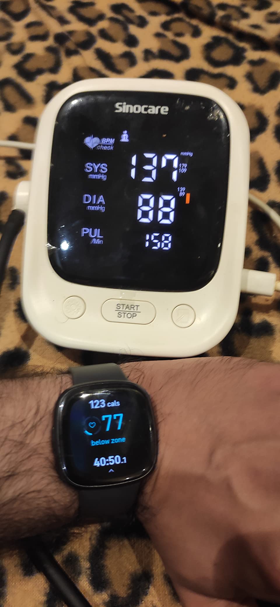 Fitbit Sense 2 Health and Fitness Smartwatch - Shadow Grey/Graphite | with Stress and Sleep Tools - 3-Month Google Health Premium Membership Included - ECG App, SpO2, 24/7 Heart Rate, and GPS customer photo 2