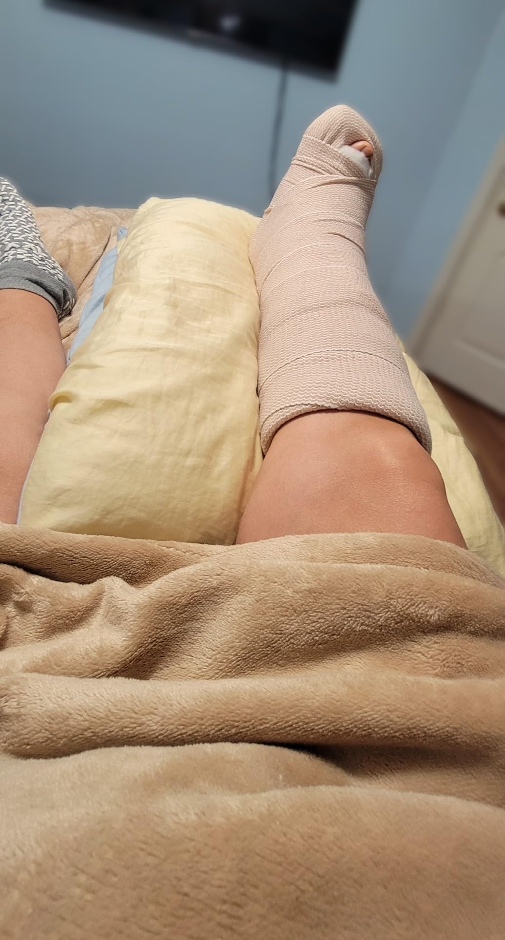 Kolbs Double Leg Elevation Pillow | Post Surgery Leg Pillow | Stylish Chic Jacquard Cover customer photo 1