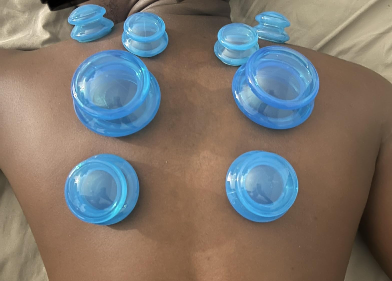 Silicone Cupping Set, Cupping Kit for Massage Therapy and Cellulite, 8 Cups | Professional Massage Cupping Cups, Myofascial Release, Body Sculpt Cup, Cellulite Reduction Suction Cups for Body and Back customer photo 2