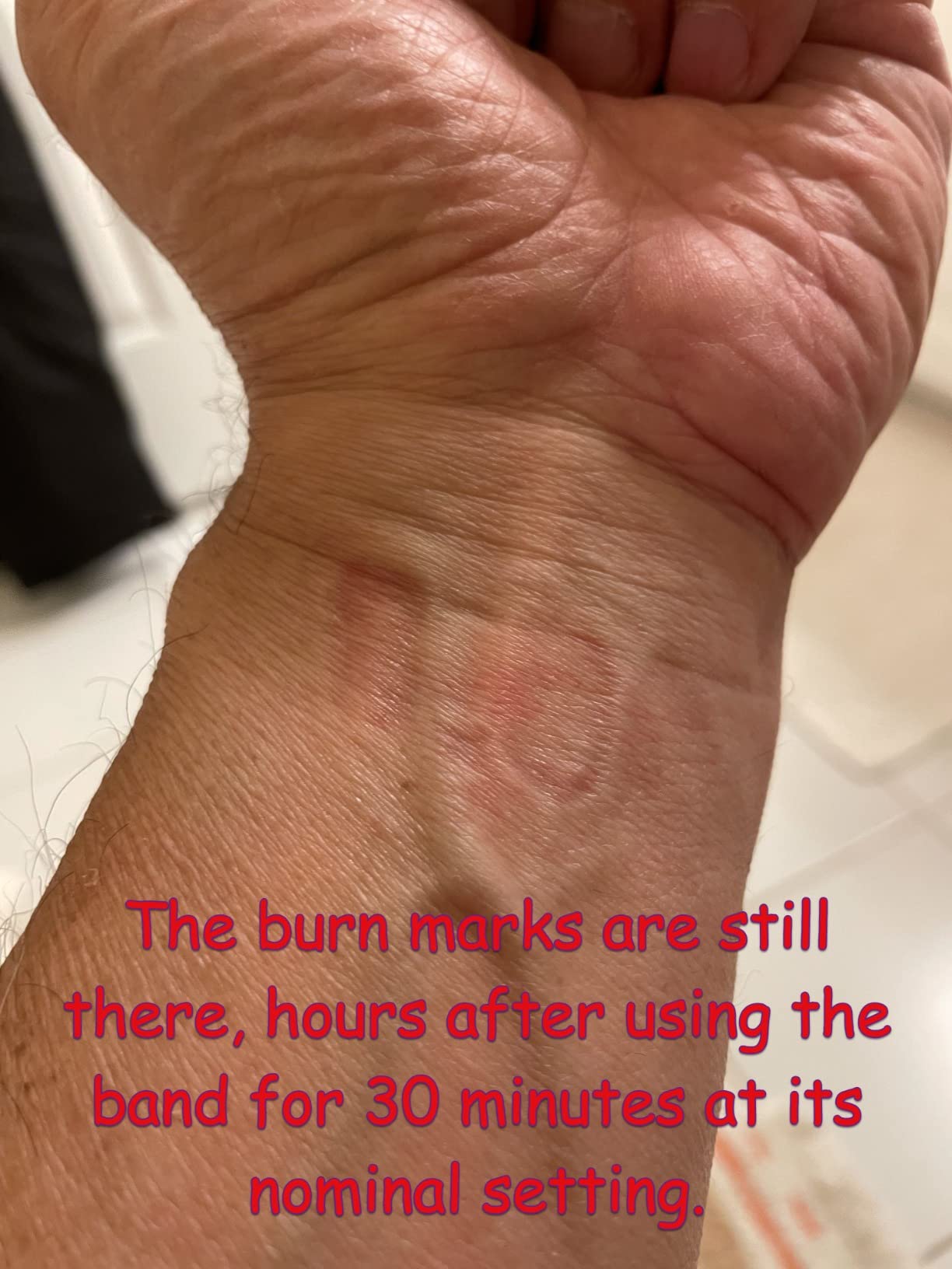 EmeTerm Fashion FDA-Cleared Relieve Nausea Electrode Stimulator Morning Sickness Motion Travel Sickness Vomit Relief Rechargeable No Gel Drug Free Wrist Bands Without Side Effects customer photo 1