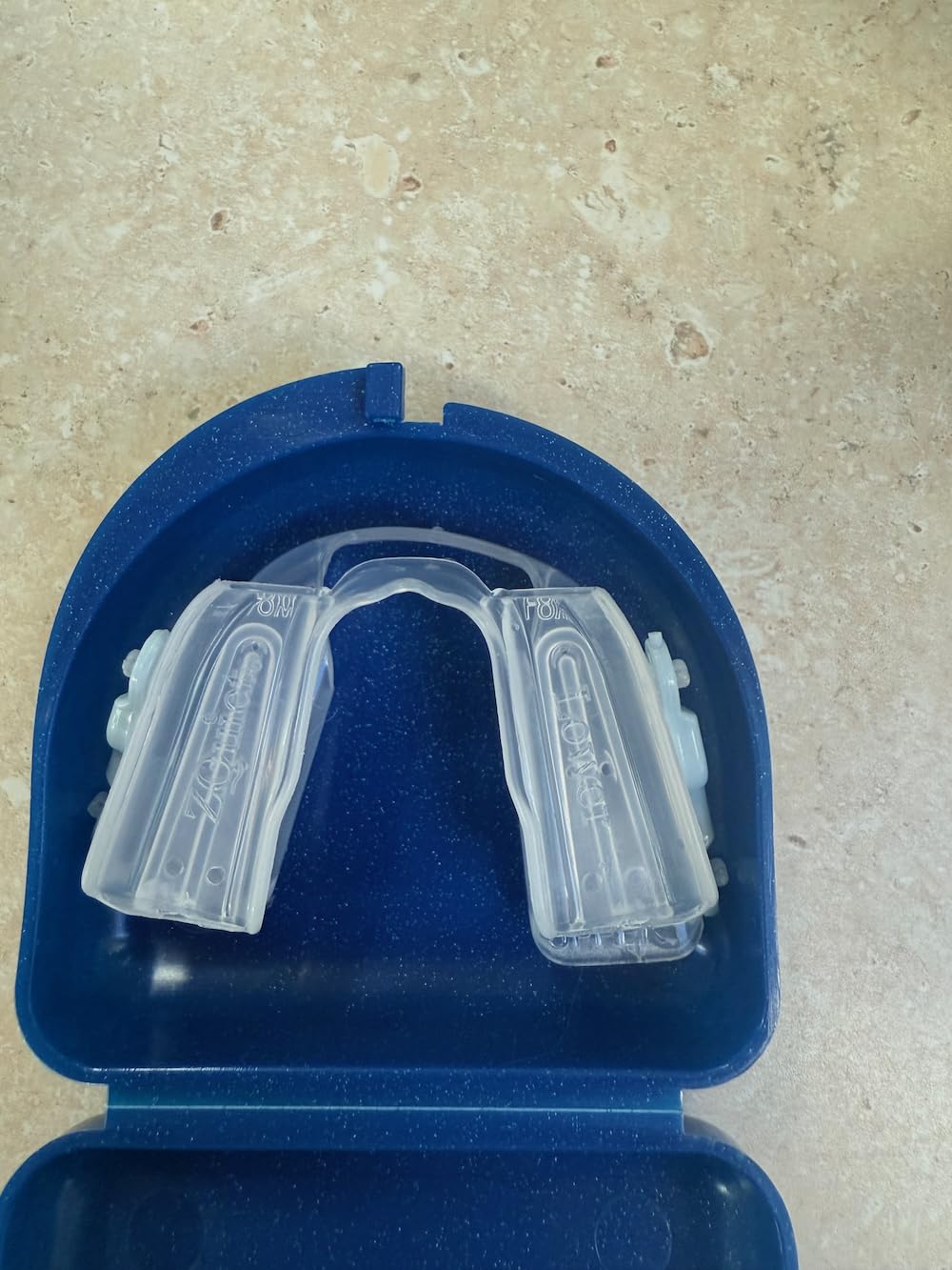 ZQuiet Advance Custom Anti-Snoring Mouthpiece, 4-Level Jaw Advancement customer photo 1