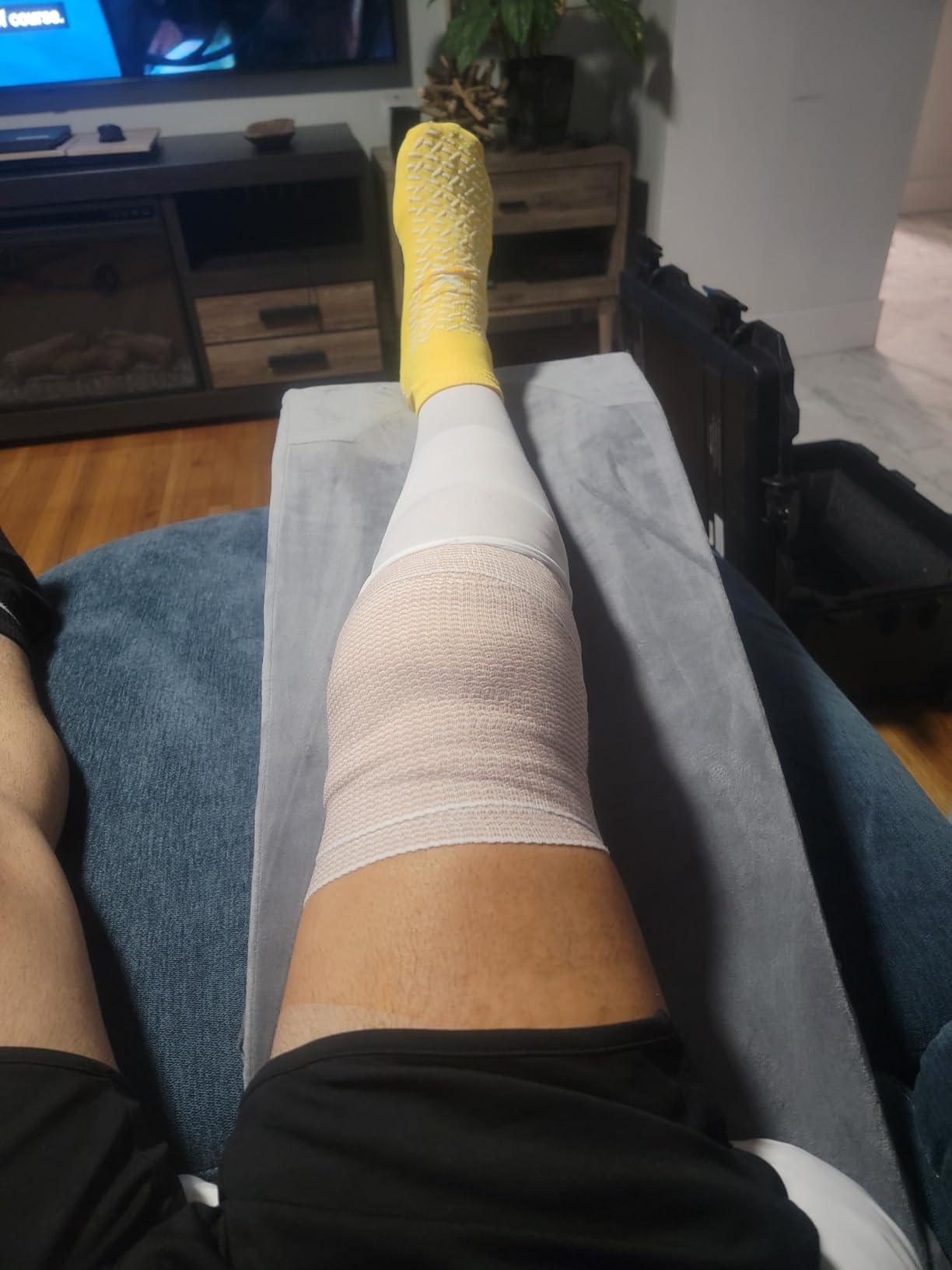 ROYALAY Leg Elevation Pillows for After Surgery, Adjustable Height Knee Surgery Recovery Equipment, Knee Replacement Recovery Aids for Hip Ankle Pain Relief Patent Pending customer photo 1