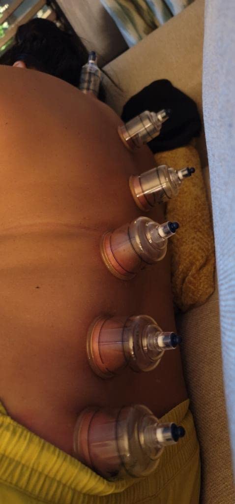 KS Premium Quality Cupping Set w/ 19 Cups - BEST CUPPING SET IN KOREA customer photo 2