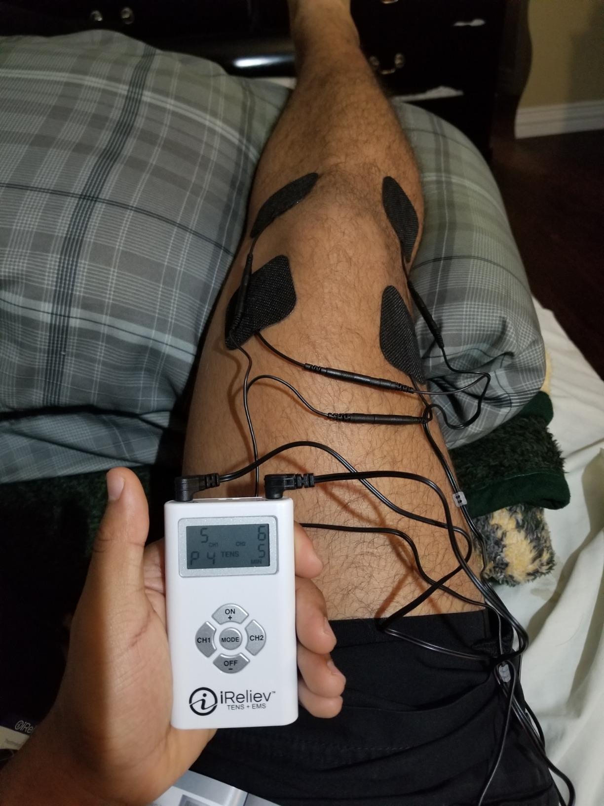 iReliev TENS + EMS Combination Unit Muscle Stimulator for Pain Relief, Arthritis, Muscle Strength - Treats Tired, Sore Muscles in Your Shoulders, Back, Ab's, Legs, Knee's, More customer photo 1