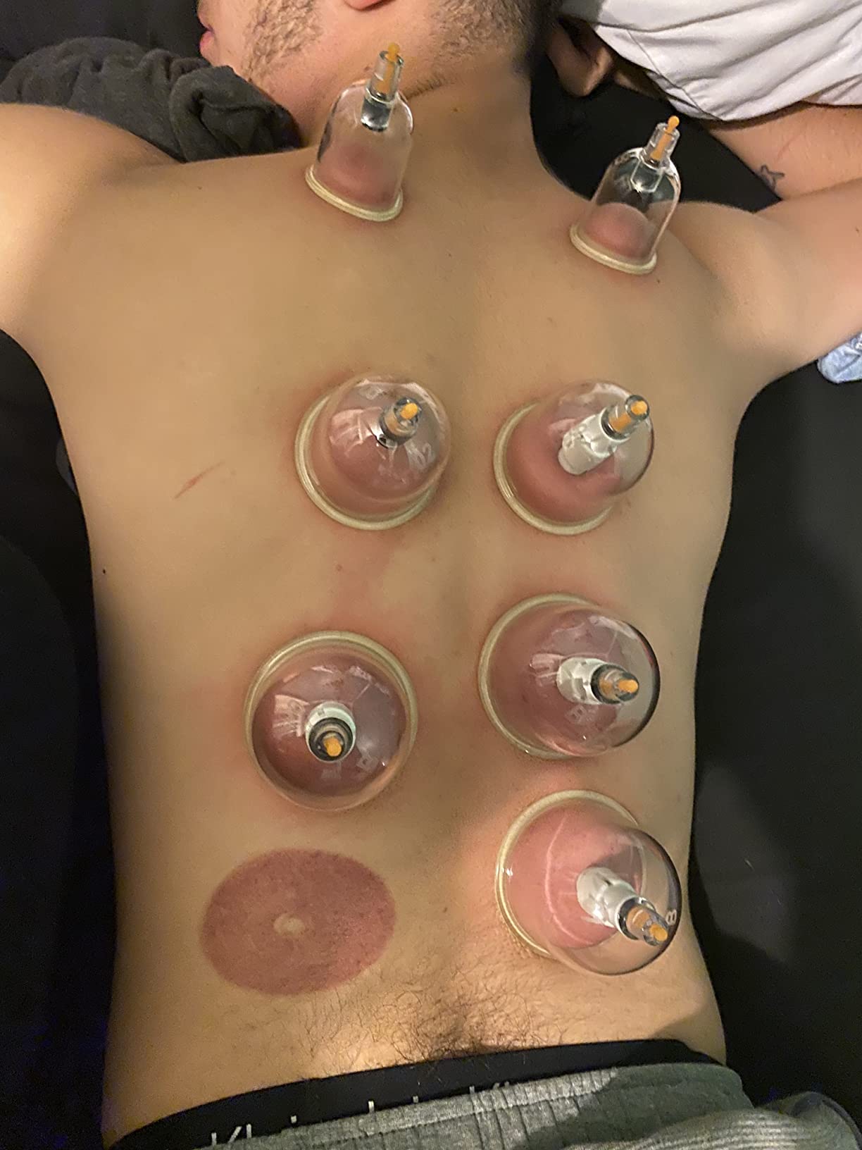 Cupping Kit, Cupping Therapy Sets Massage Back, Pain Relief, Physical Therapy, Chinese Muscle Cupping Tool with Pump & Vacuum Silicone Cups for Cellulite Reduction at Home customer photo 1