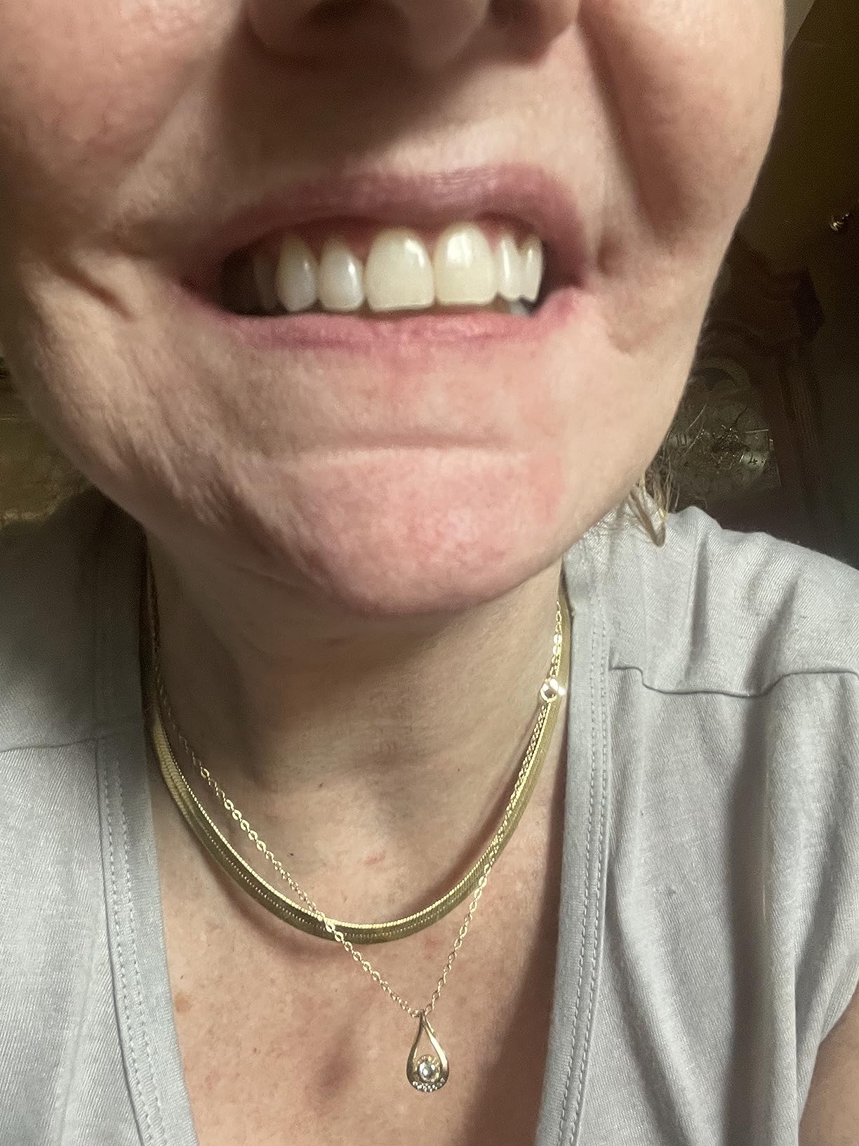 Pdoo Teeth Whitening Kit with LED Light for Sensitive Teeth, Fast Results for Brightening at Home, Teeth Whitening Gel Helps Remove All Kinds of Stains customer photo 2