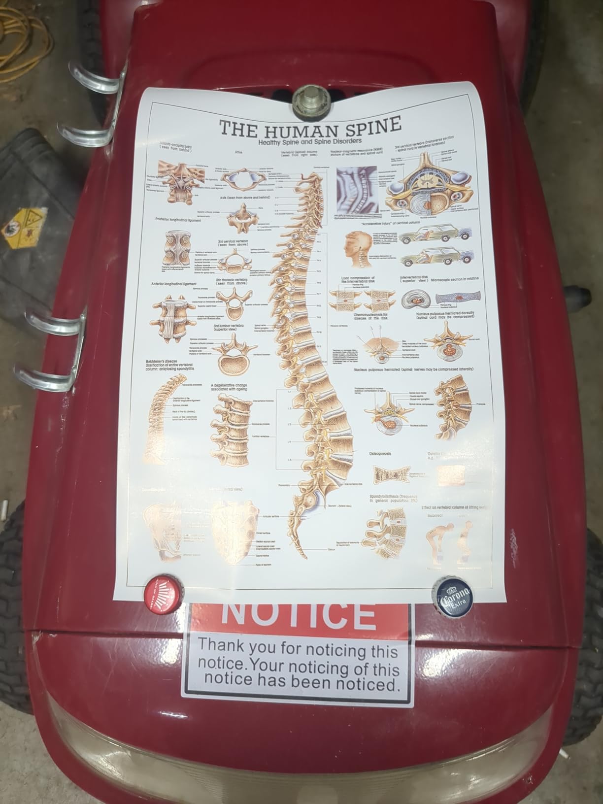NLShan Human Skeleton Model for Anatomy -Life Size Anatomical Skeleton Medical Model with Nervous System 70.8 in with Rolling Stand for Study and Display Colorful Posters customer photo 1