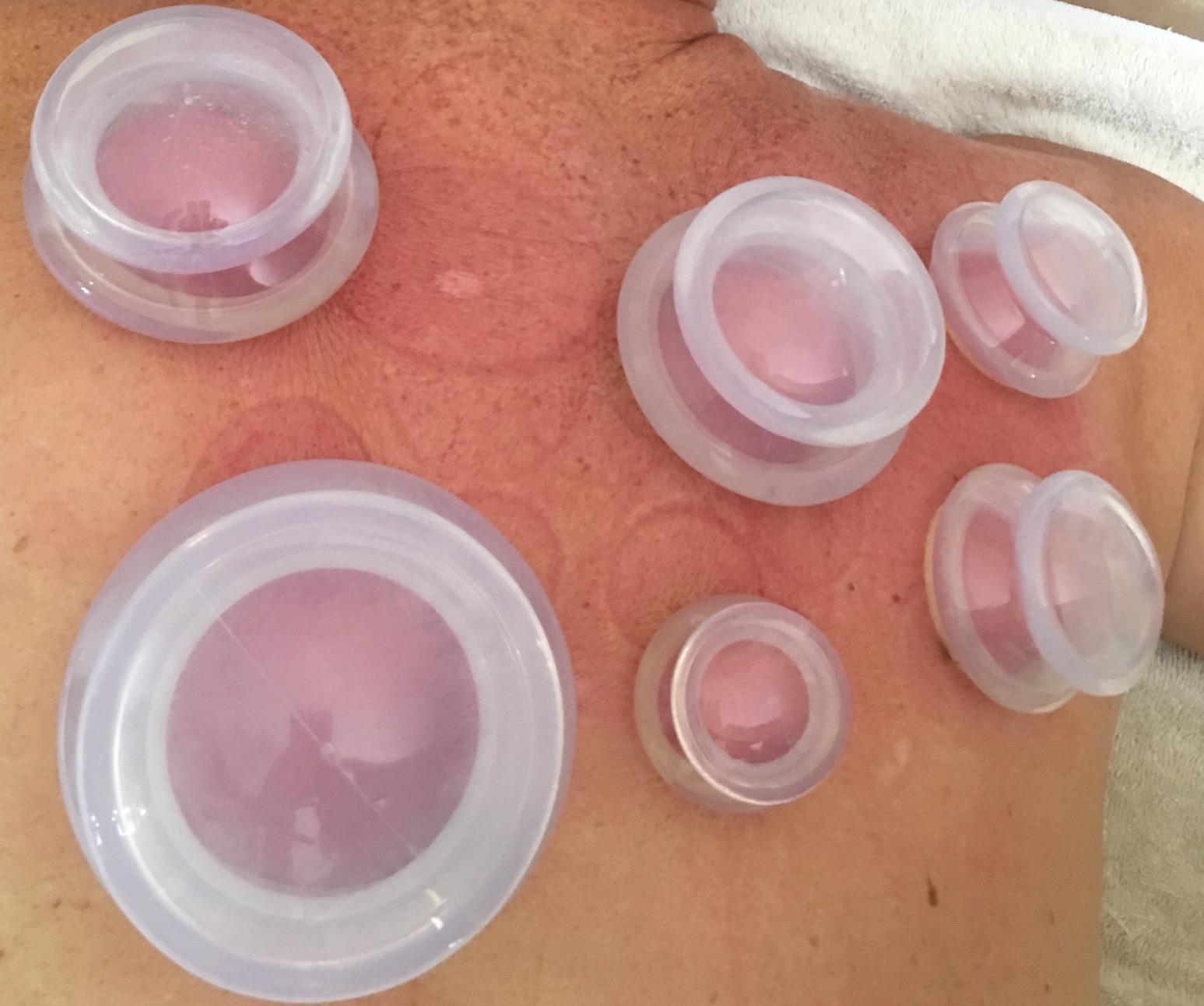 Silicone Cupping Set, Cupping Kit for Massage Therapy and Cellulite, 8 Cups customer photo 2