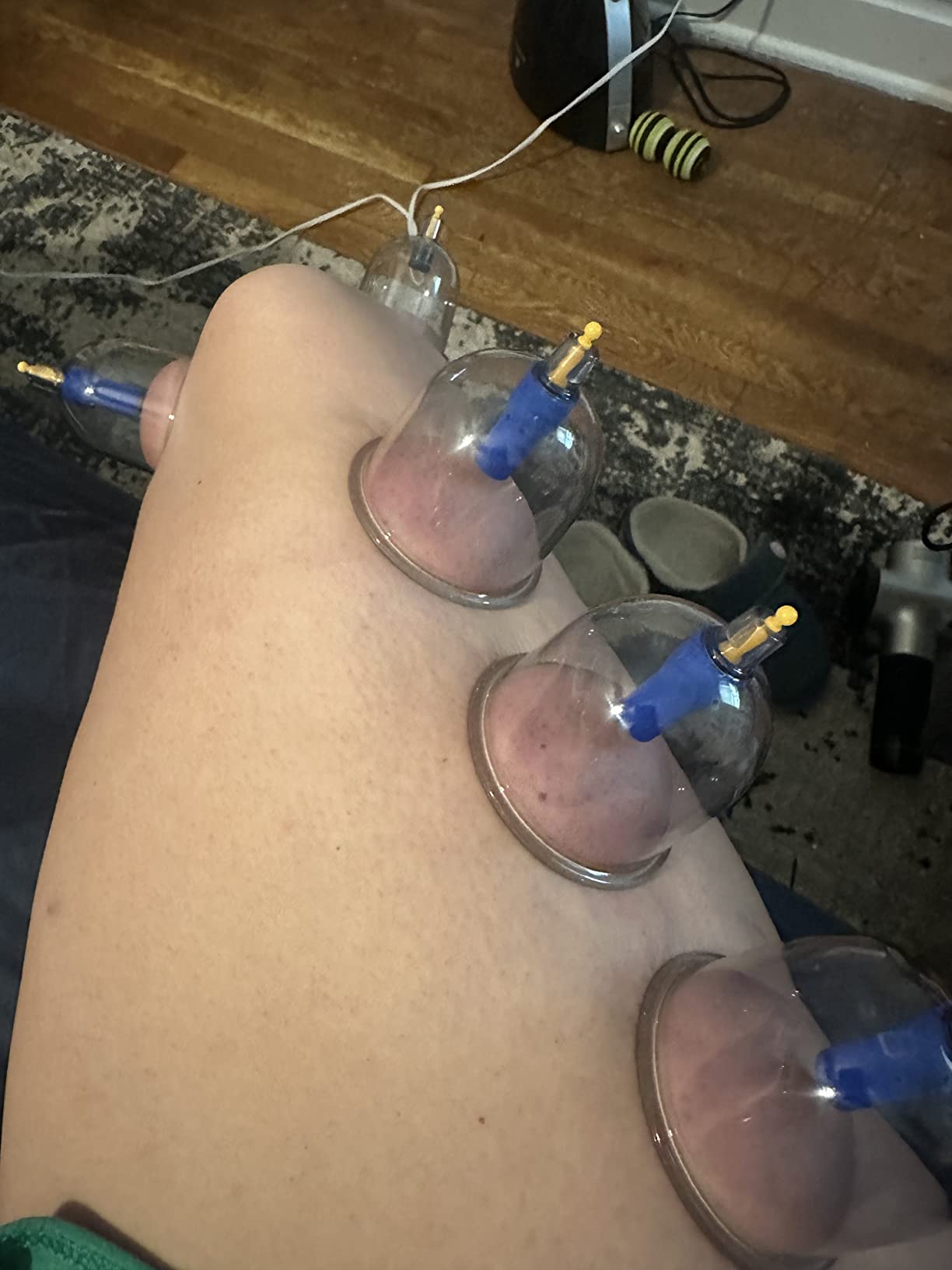 DEFUNX Cupping Set, 19 Cups Cupping Kit for Massage Therapy, Cupping Therapy Set with Pump for Back Massage, Pain Relief, Physical Therapy customer photo 1