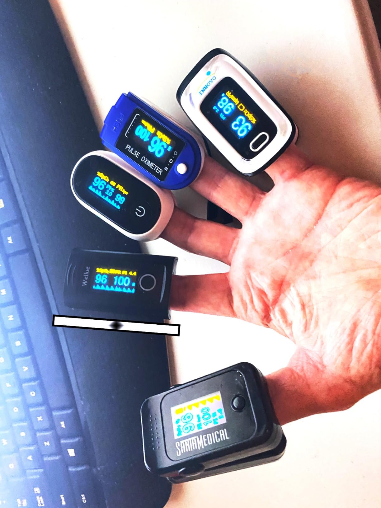 Wellue Bluetooth Pulse Oximeter Fingertip, Blood Oxygen Saturation Monitor with Built-in Memory, OLED Screen, Batteries, Free APP, Carry Bag & Lanyard customer photo 1