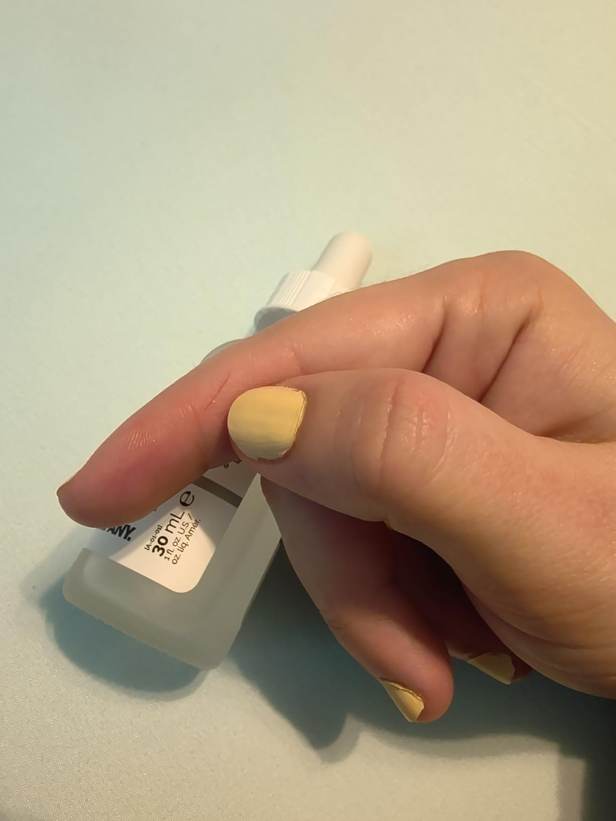 The Ordinary Niacinamide 10% + Zinc 1%, Smoothing Serum for Blemish-Prone Skin customer photo 1