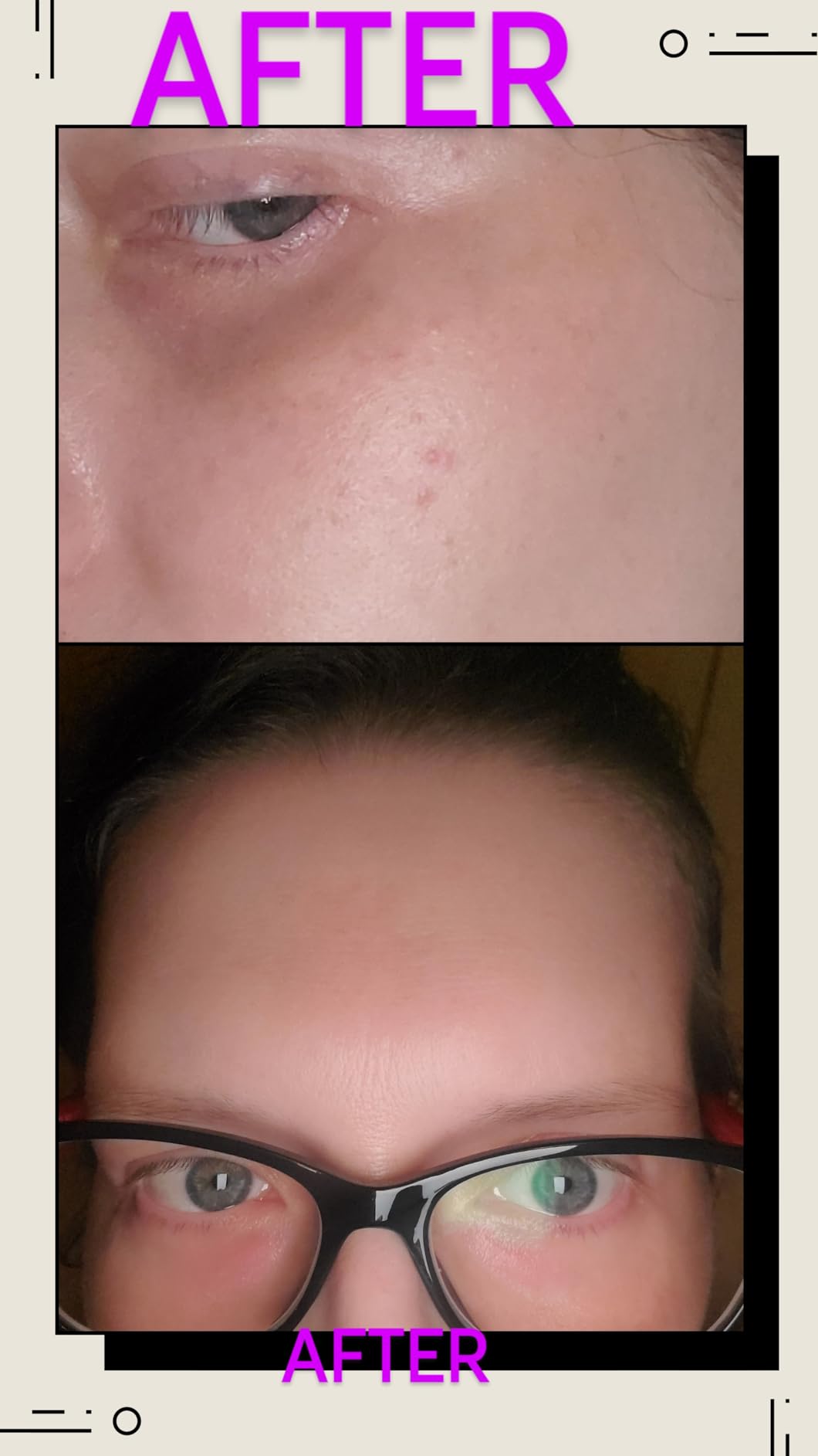 CeraVe Resurfacing Retinol Face Serum with Niacinamide, Pore Minimizer, 1oz customer photo 2