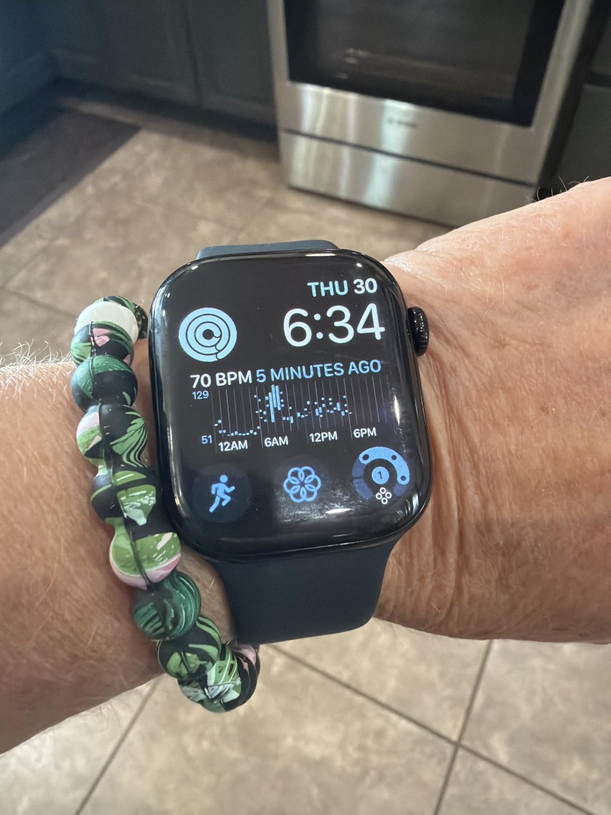 Apple Watch Series 11 customer photo 2