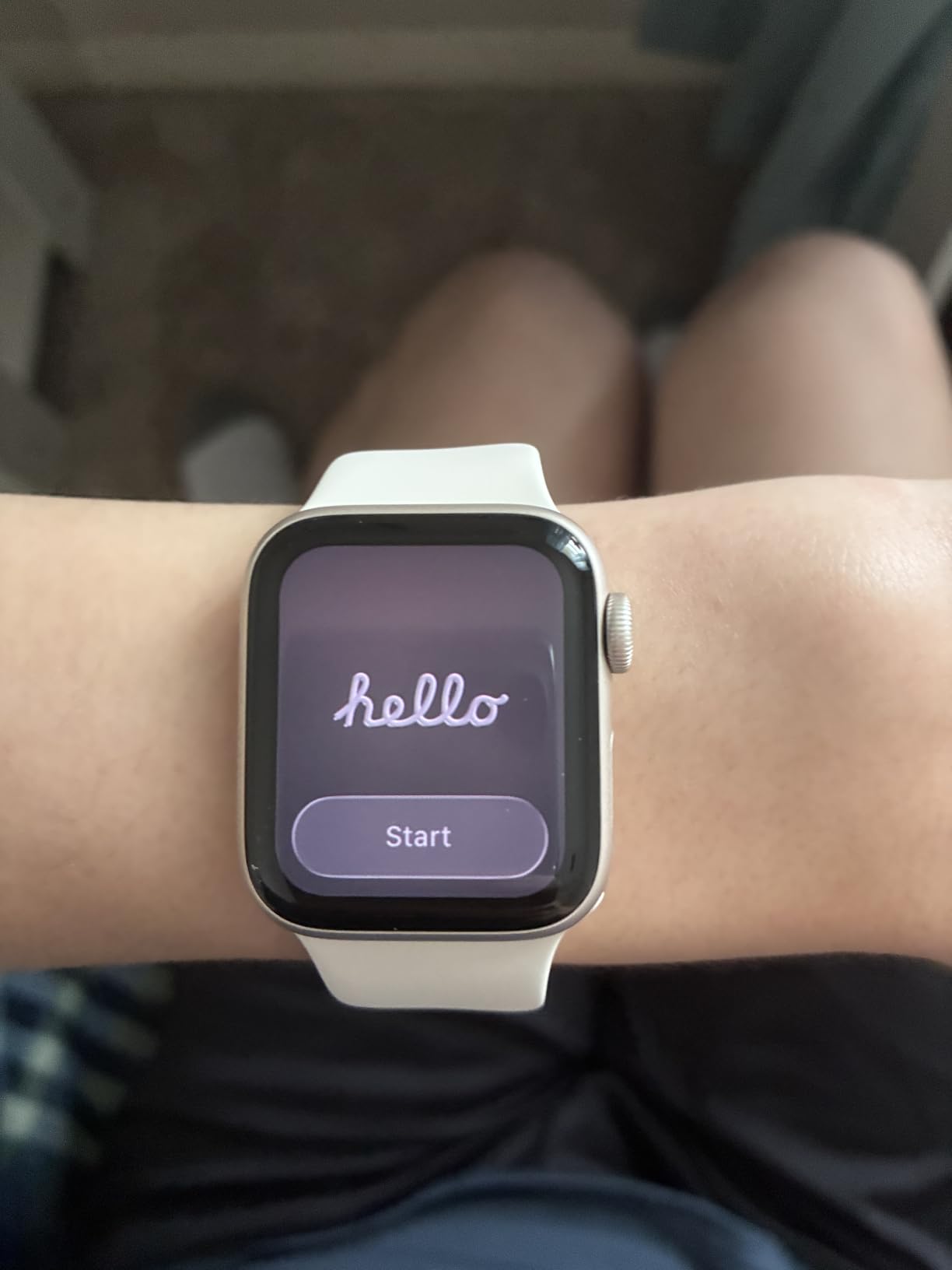 Apple Watch SE 3 customer photo 2